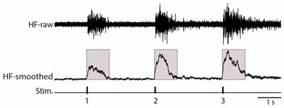Turtle Flexion Reflex Motor Patterns Show Windup, Mediated Partly by L-type Calcium Channels